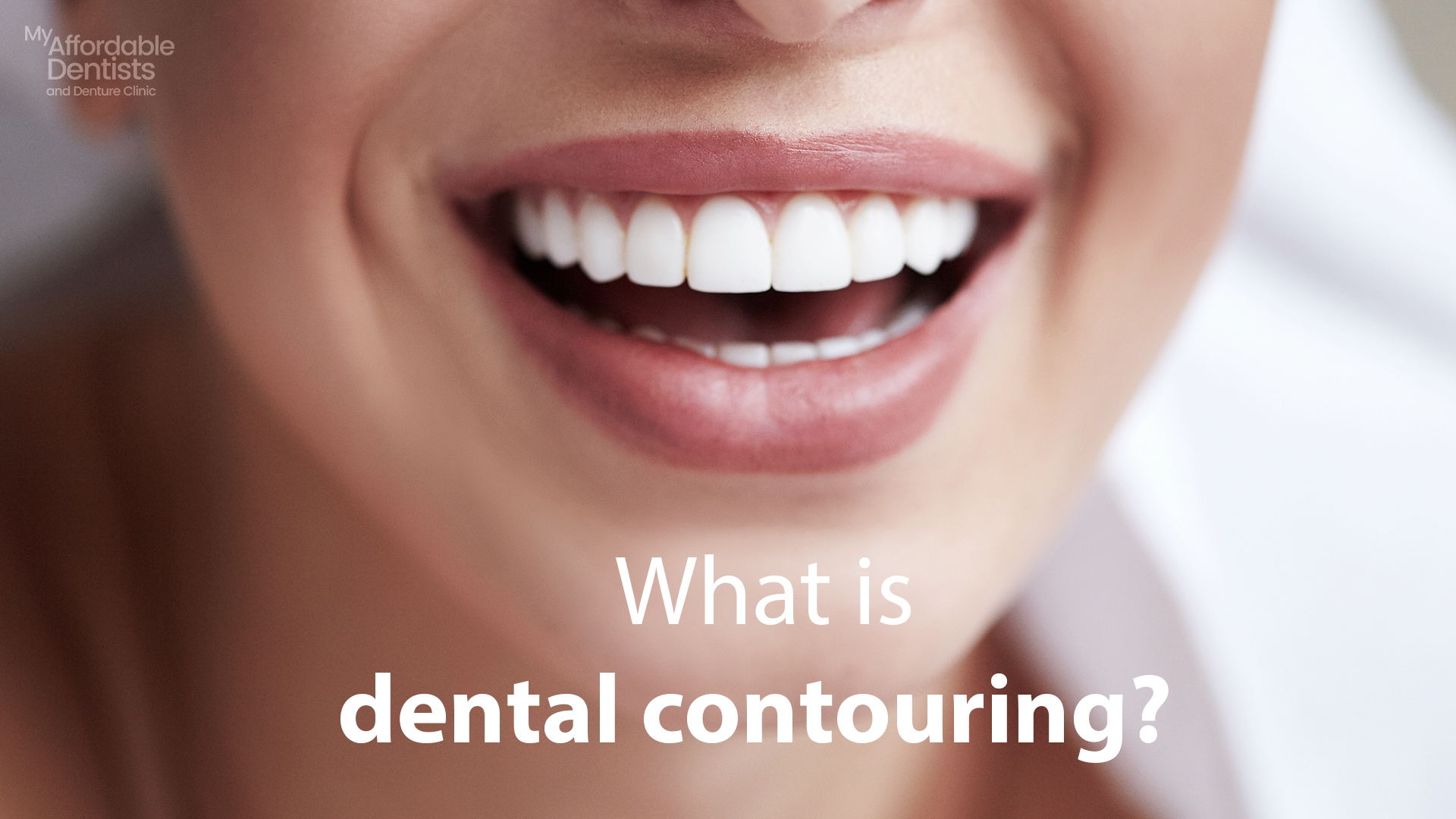 What is Dental Contouring? My Affordable Dentists Mandurah